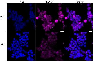 Immunocytochemical staining of HeLa cells using SOX9 antibody (ABIN7800973), 1:1,000), Top panel: wild-type (WT), Bottom panal: SOX9 shRNA knockdown (KD). (Recombinant SRY-Box Transcription Factor 9 antibody)