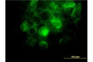 Immunofluorescence of monoclonal antibody to ITGA2 on A-431 cell. (ITGA2 antibody  (AA 30-119))