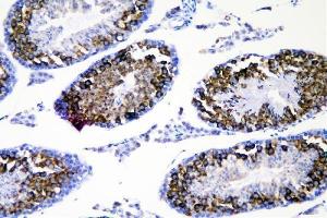 IHC analysis of DDX4 using anti-DDX4 antibody (ABIN7601203). (DDX4 antibody  (AA 3-666))