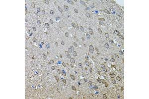 Immunohistochemistry of paraffin-embedded mouse brain using ANXA8L2 antibody (ABIN5975720) at dilution of 1/100 (40x lens). (ANXA8L2 antibody)