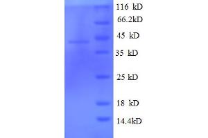 SDS-PAGE (SDS) image for Tubulin Folding Cofactor C (TBCC) (AA 2-345) protein (His tag) (ABIN4975993) (TBCC Protein (AA 2-345) (His tag))
