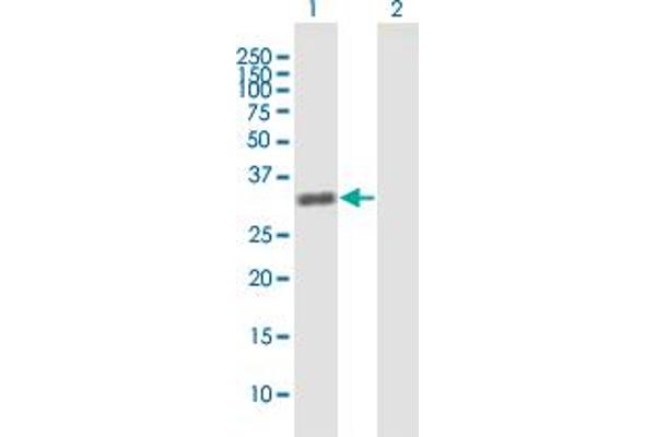 ZBTB49 anticorps  (AA 1-248)