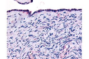 Anti-THRA antibody IHC of human surface epithelium. (THRA antibody  (Ligand Binding Domain))