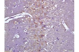 Formalin-fixed and paraffin embedded rat brain labeled with Anti-phospho-CaMK2 alpha (Tyr231) Polyclonal Antibody, Unconjugated (ABIN683848) at 1:200 followed by conjugation to the secondary antibody and DAB staining (CAMK2B antibody  (pTyr230))