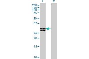 Western Blot analysis of DHRS4 expression in transfected 293T cell line by DHRS4 MaxPab polyclonal antibody. (DHRS4 antibody  (AA 1-278))