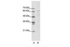 Image no. 1 for anti-Calcium Channel, Voltage-Dependent, beta 3 Subunit (CACNB3) (AA 391-440) antibody (ABIN202640) (CACNB3 antibody  (AA 391-440))