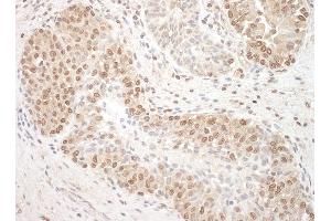 Immunohistochemistry (IHC) image for anti-Tuftelin Interacting Protein 11 (TFIP11) (AA 1-50) antibody (ABIN7453802)