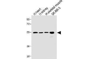 All lanes : Anti-SPNS2 Antibody (N-term) at 1:1000 dilution Lane 1: Human heart lysate Lane 2: Human kidney lysate Lane 3: Human skeletal muscle lysate Lane 4: SK-BR-3 whole cell lysate Lysates/proteins at 20 μg per lane. (SPNS2 antibody  (N-Term))