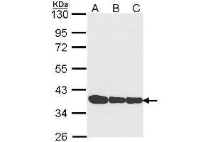 WB Image Sample (30 ug of whole cell lysate) A: A431 , B: H1299 C: Hela 10% SDS PAGE antibody diluted at 1:1000 (Annexin a1 antibody)