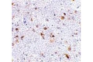 Immunohistochemistry (IHC) image for anti-Programmed Cell Death 1 Ligand 2 (PDCD1LG2) (Middle Region) antibody (ABIN1031035) (PDCD1LG2 antibody  (Middle Region))