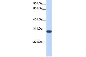 DUSP19 antibody used at 1 ug/ml to detect target protein. (DUSP19 antibody  (C-Term))