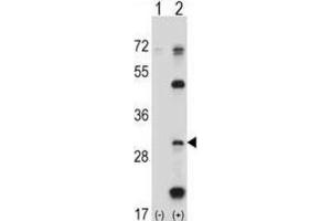 Western Blotting (WB) image for anti-Proteasome (Prosome, Macropain) Subunit, beta Type, 5 (PSMB5) antibody (ABIN2998050) (PSMB5 antibody)
