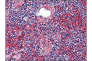Immunohistochemistry: Human Thymus: Formalin-Fixed, Paraffin-Embedded (FFPE). (Cell Adhesion Molecule 4 antibody  (Internal Region))