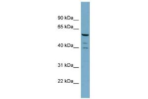 WB Suggested Anti-RABGEF1 Antibody Titration: 0.