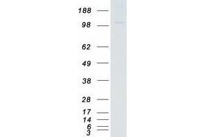 Validation with Western Blot (TAO Kinase 2 Protein (TAOK2) (Transcript Variant 1) (Myc-DYKDDDDK Tag))