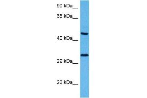 Host:  Mouse  Target Name:  SOX1  Sample Tissue:  Mouse Pancreas  Antibody Dilution:  1ug/ml (SOX1 antibody  (N-Term))