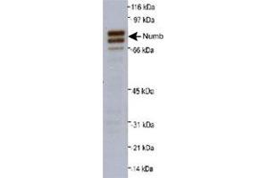 Western blot analysis of Numb isoforms 1 and 2 in A-431 whole cell lysate (20 ug) with Numb polyclonal antibody at 0.