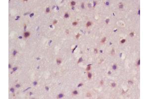 Formalin-fixed and paraffin embedded rat brain labeled with Rabbit Anti-Frizzled 10/CD350 Polyclonal Antibody, Unconjugated  at 1:200 followed by conjugation to the secondary antibody and DAB staining (FZD10 antibody  (AA 101-200))