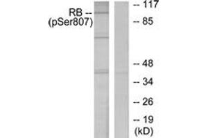 Western blot analysis of extracts from K562 cells treated with serum 10%, using Retinoblastoma (Phospho-Ser807) Antibody. (Retinoblastoma Protein (Rb) antibody  (pSer807))