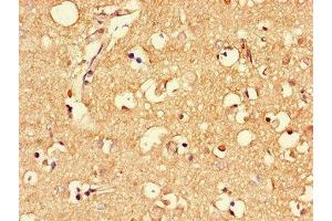 Immunohistochemistry of paraffin-embedded human brain tissue using ABIN7159344 at dilution of 1:100 (MLC1 antibody  (AA 1-49))