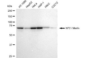 Western blotting analysis using NF2 / Merlin antibody (ABIN7799579).