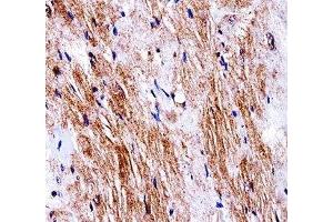 Ddr2 antibody immunohistochemistry analysis in formalin fixed and paraffin embedded mouse heart tissue. (DDR2 antibody  (AA 816-843))