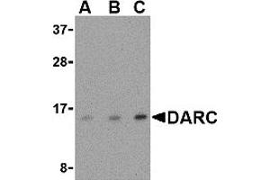 Western Blotting (WB) image for anti-Duffy Blood Group, Chemokine Receptor (DARC) (N-Term) antibody (ABIN1031343) (DARC antibody  (N-Term))
