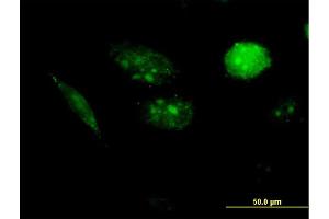 Immunofluorescence of purified MaxPab antibody to AURKAIP1 on HeLa cell. (AURKAIP1 antibody  (AA 1-199))