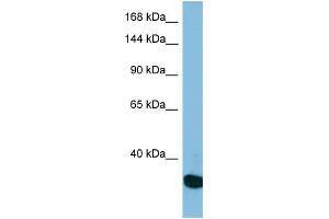 Western Blotting (WB) image for anti-Ubiquitin Specific Peptidase 36 (USP36) (N-Term) antibody (ABIN2501016) (USP36 antibody  (N-Term))