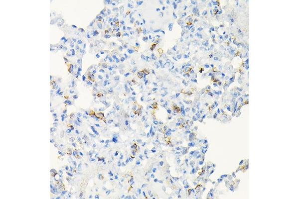 ACE2 antibody  (AA 18-250)