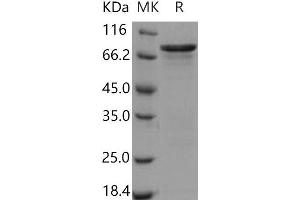 Western Blotting (WB) image for Checkpoint Kinase 1 (CHEK1) (Active) protein (GST tag) (ABIN7317105) (CHEK1 Protein (GST tag))