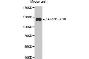 Western blot analysis of extracts from mouse Brain tissue, using phospho-GRIN1-S896 antibody (ABIN2987488). (GRIN1/NMDAR1 antibody  (pSer896))