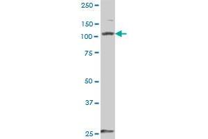 DDX58 MaxPab polyclonal antibody. (DDX58 antibody  (AA 1-925))
