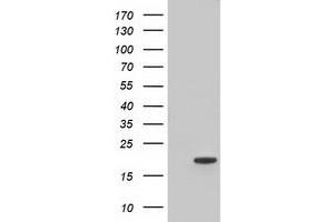 HEK293T cells were transfected with the pCMV6-ENTRY control (Left lane) or pCMV6-ENTRY TTC32 (Right lane) cDNA for 48 hrs and lysed. (TTC32 antibody)