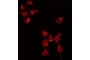 ABIN6274475 staining HeLa by IF/ICC. (PGBD1 antibody  (Internal Region))
