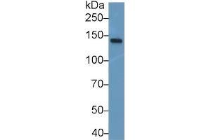 Detection of NEF3 in Mouse Spinal cord lysate using Polyclonal Antibody to Neurofilament 3 (NEF3) (NEFM antibody  (AA 105-287))