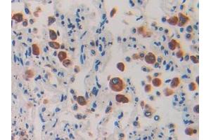 IHC-P analysis of Human Lung Tissue, with DAB staining. (IL1RAP antibody  (AA 65-249))