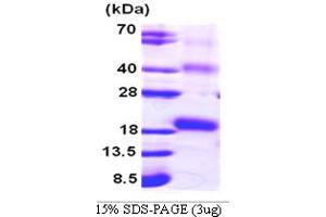 SDS-PAGE (SDS) image for Interleukin 18 (IL18) (AA 36-192) protein (His tag) (ABIN666748)