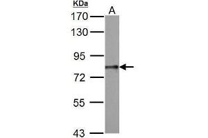 WB Image DDX3 antibody detects DDX3Y protein by Western blot analysis. (DDX3X antibody  (Center))