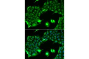 Immunofluorescence analysis of HeLa cell using SSX2 antibody. (SSX2 antibody)