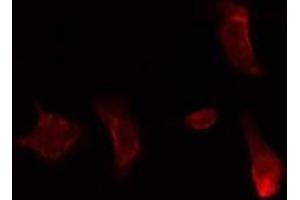 ABIN6275857 staining  HuvEc cells by IF/ICC. (CAMKK2 antibody  (C-Term))