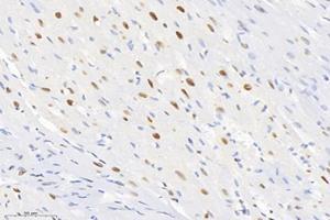 Immunohistochemistry analysis of paraffin-embedded rat heart using,SET (ABIN7075583) at dilution of 1: 10000 (SET/TAF-I antibody)