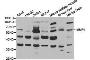 Western Blotting (WB) image for anti-Matrix Metallopeptidase 1 (Interstitial Collagenase) (MMP1) antibody (ABIN1873712) (MMP1 antibody)