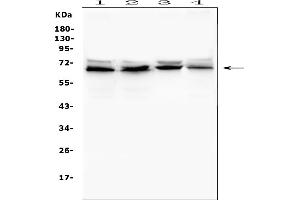 Western blot analysis of IFNAR2 using anti-IFNAR2 antibody (ABIN7601353). (IFNAR2 antibody  (AA 33-466))