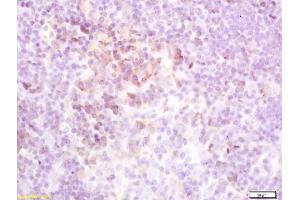Formalin-fixed and paraffin embedded mouse spleen labeled with Rabbit Anti-TSHR Polyclonal Antibody (ABIN668901) at 1:200 followed by conjugation to the secondary antibody and DAB staining