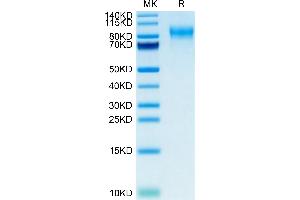 PODXL2 Protein (AA 29-499) (His tag)