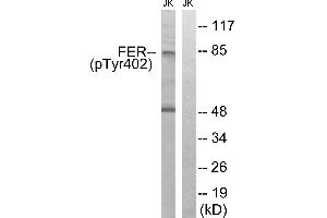 Immunohistochemistry analysis of paraffin-embedded human brain tissue using FER (Phospho-Tyr402) antibody.