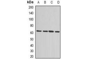 Western blot analysis of MSMB expression in HepG2 (A), Jurkat (B), MCF7 (C), mouse liver (D) whole cell lysates. (MSMB antibody)