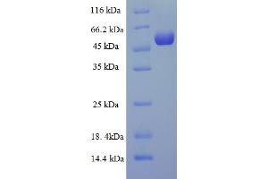 SDS-PAGE (SDS) image for tyrosylprotein Sulfotransferase 2 (TPST2) (AA 26-377) protein (His-SUMO Tag) (ABIN4975438)