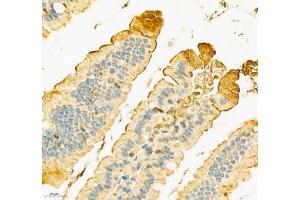 Immunohistochemistry of paraffin embedded mouse duodenum using SLC6A19 (ABIN7075682) at dilution of 1:900 (400x lens) (SLC6A19 antibody)